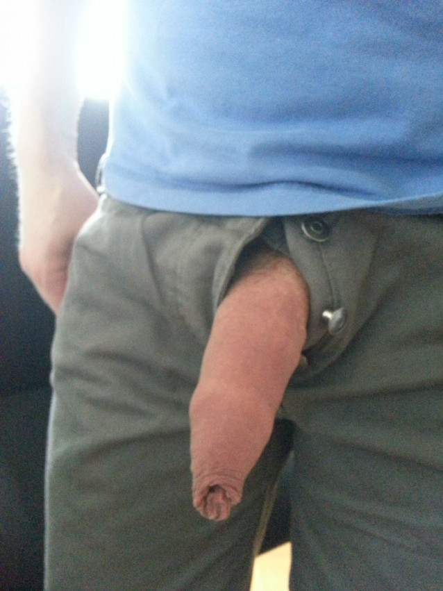 Operation dissection member bridle